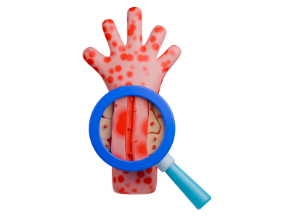 Immune thrombocytopenia: Why is diagnosis sometimes difficult?