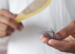  Hair loss (alopecia): Everything you need to know! 