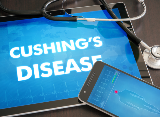 Cushing's syndrome: everything there is to know