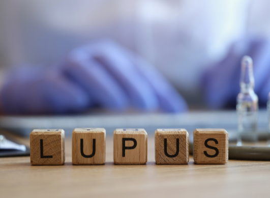 Types of lupus explained: systemic, cutaneous, drug-induced and neonatal lupus