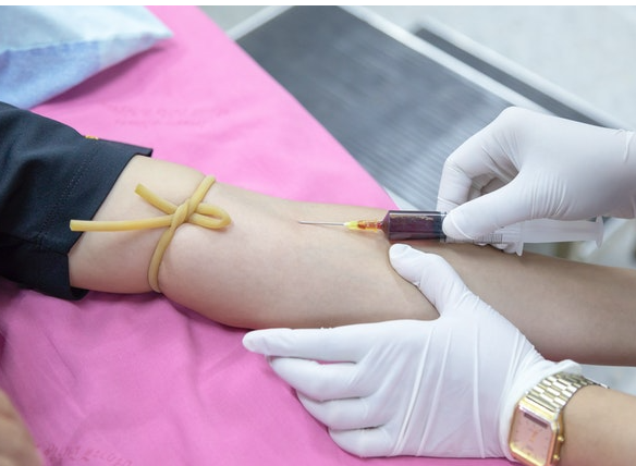 Blood tests: How to read and understand the results of a liver function test