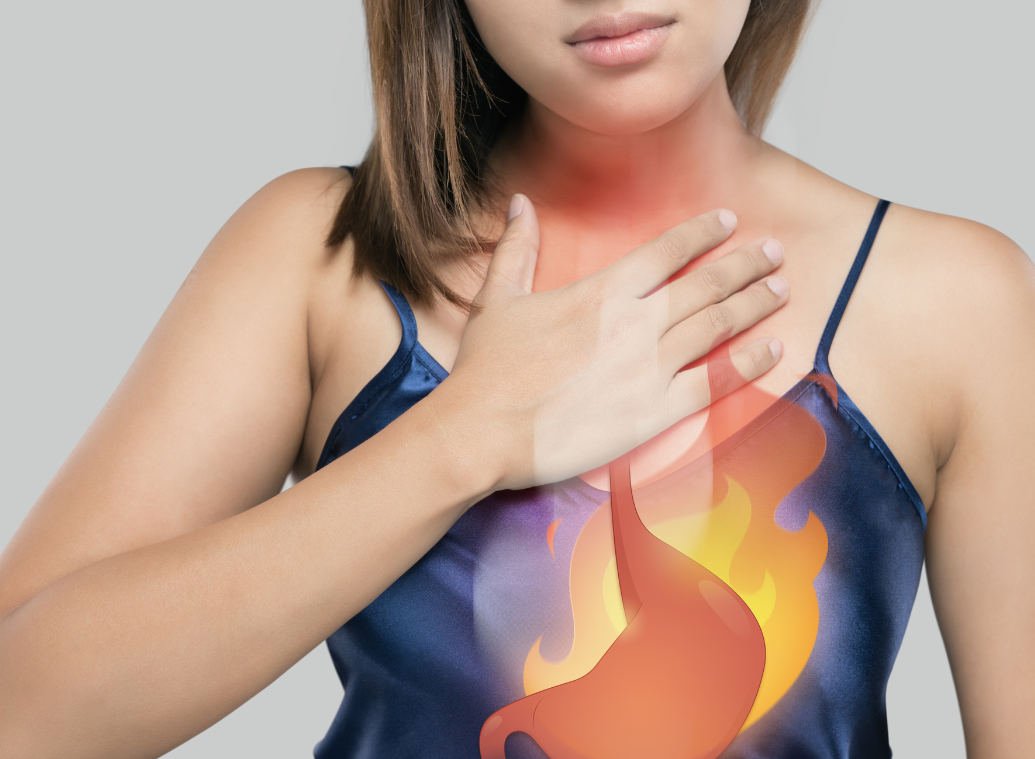 Gastro-esophageal reflux disease (GERD): causes, symptoms and treatments